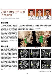 脑科肿瘤爆料案例最新,最新爆料揭示治疗挑战与希望 第1张 脑科肿瘤爆料案例最新,最新爆料揭示治疗挑战与希望 第1张